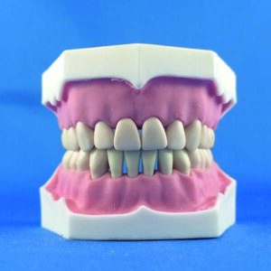 Modello completo superiore e inferiore a 32 denti per esercitazioni di protesi e conservativa con gengive in silicone iperplastico e sistema brevettato di estrazione dei denti extra duri con clip, attacco a manichino